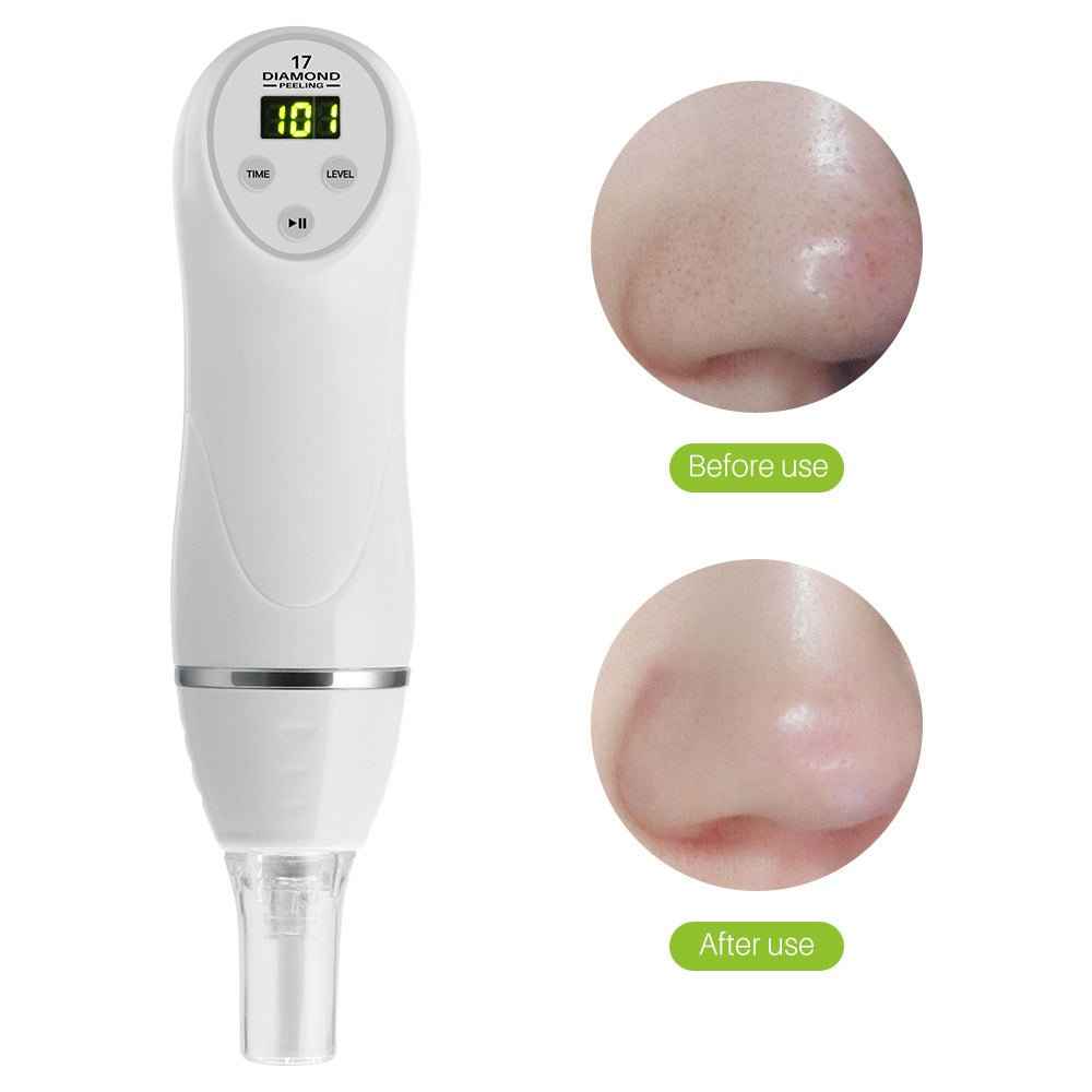 Electric Blackhead Remover & Pore Cleaner